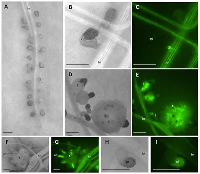 Secondary Effects of Glyphosate Action in Phelipanche aegyptiaca: Inhibition of Solute Transport from the Host Plant to the Parasite